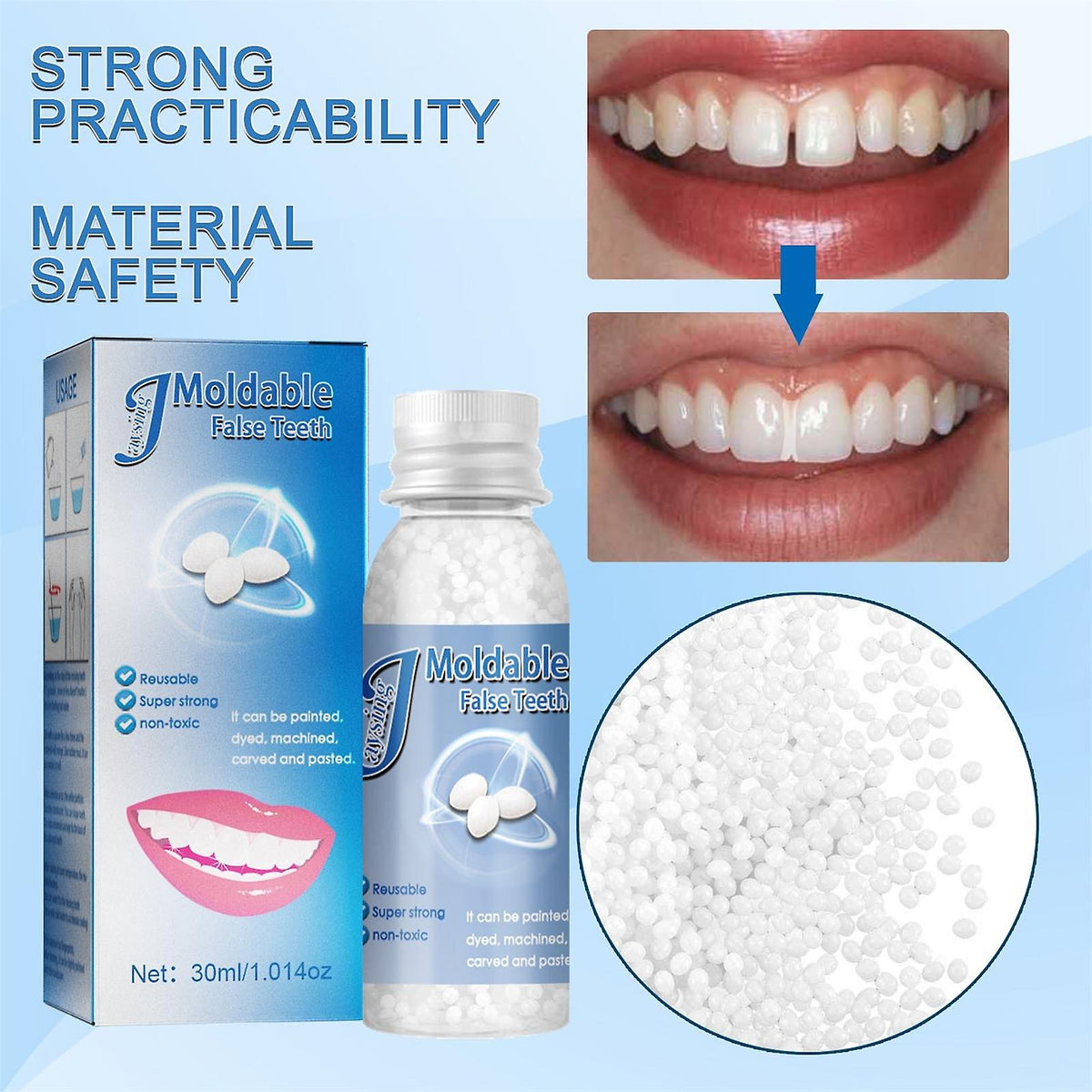 SmileRestore