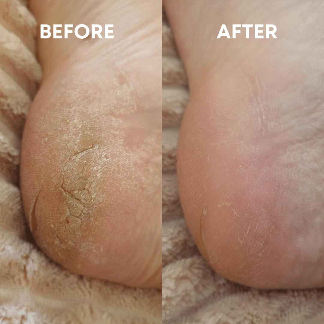 The (VIRAL) Cheeky Foot File