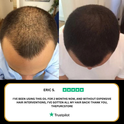 The (VIRAL) Purc™ Natural Hair Growth Oil